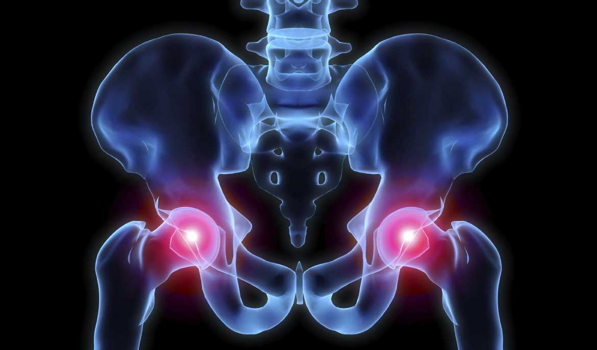 hip pain treatments Core Medical Group